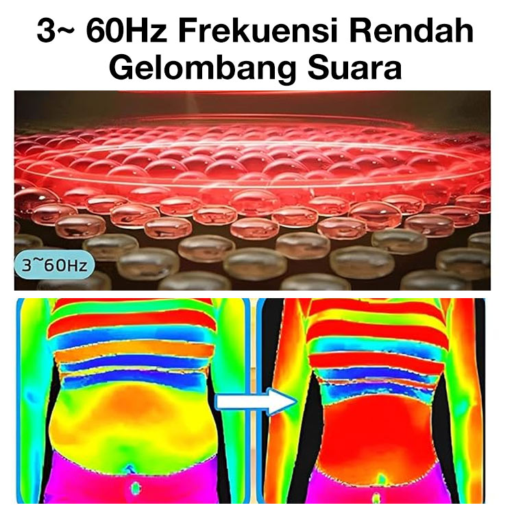 Promosi akhir tahun Garansi Satu Tahun - Gelang Pembentuk Tubuh Ultrasonik - Dapatkan bentuk tubuh ideal tanpa rasa sakit	